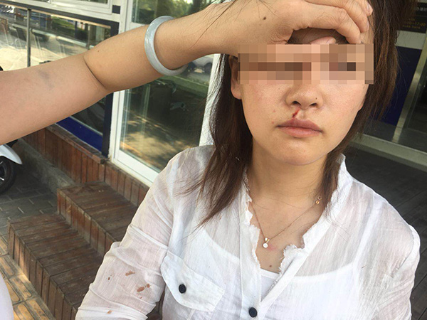 滴滴司机打伤乘客，滴滴司机打伤乘客始末曝光!